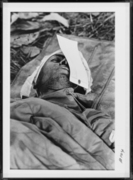 負傷した米軍兵士 画像